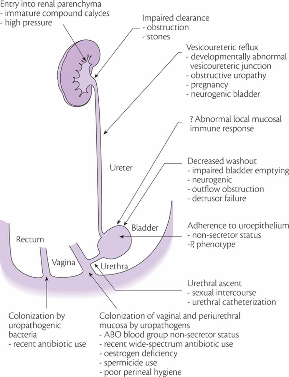 Pyelonephritis What Is? Treatment Definition Symptoms